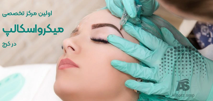میکرواسکالپ در کرج میکرواسکالپ در کرج