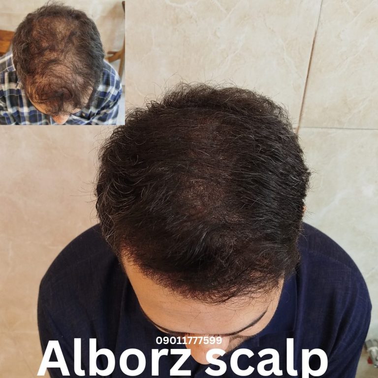 نمونه کار البرز اسکالپ-2 نمونه کار البرز اسکالپ-2