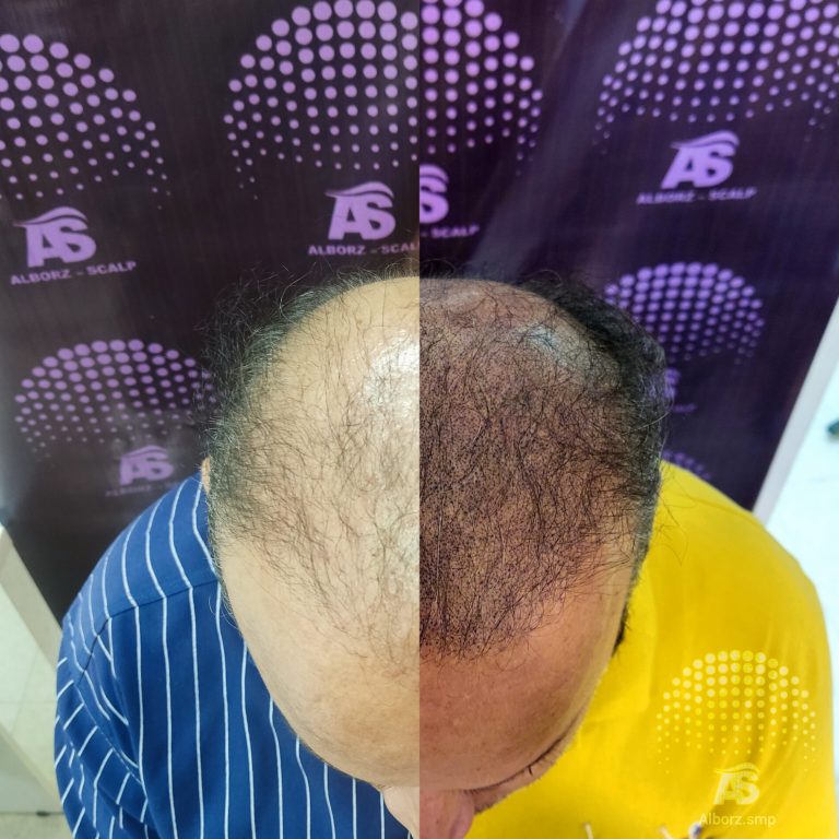 نمونه کار البرز اسکالپ-0 نمونه کار البرز اسکالپ-0