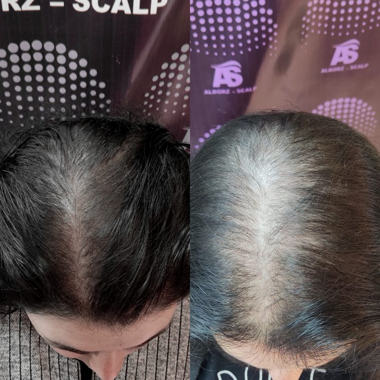 نمونه کار البرز اسکالپ-1 نمونه کار البرز اسکالپ-1