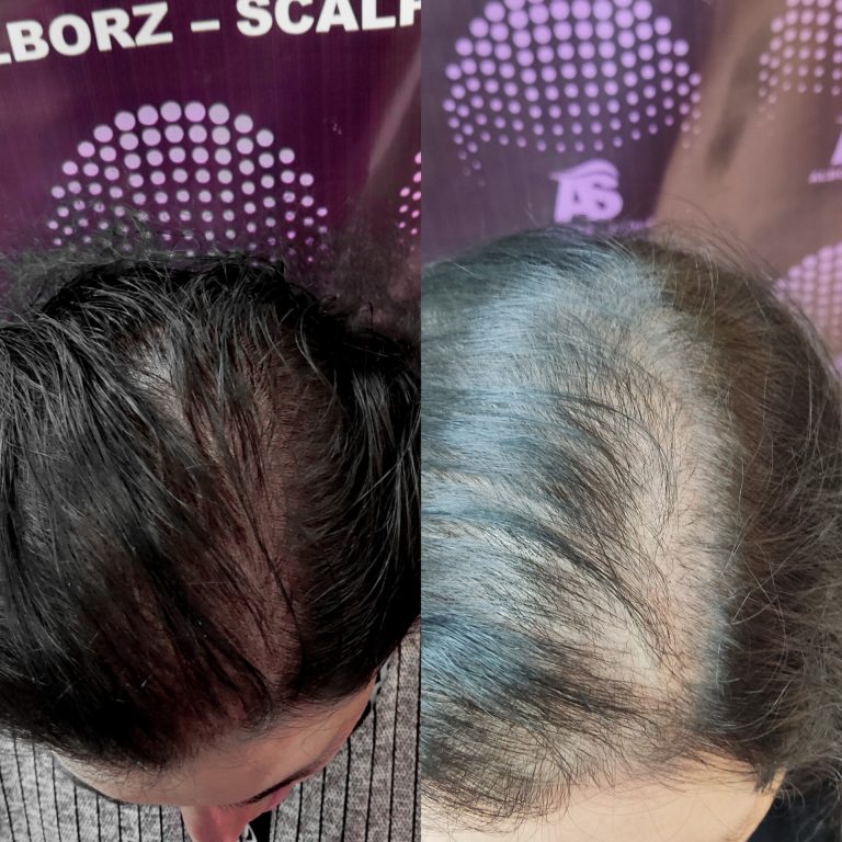 نمونه کار البرز اسکالپ-3 نمونه کار البرز اسکالپ-3