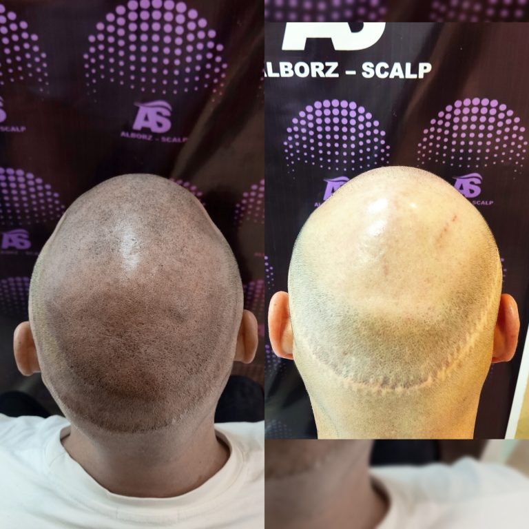 نمونه کار البرز اسکالپ-4 نمونه کار البرز اسکالپ-4